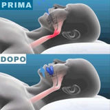 RIMORIX - Bite Anti-Russamento